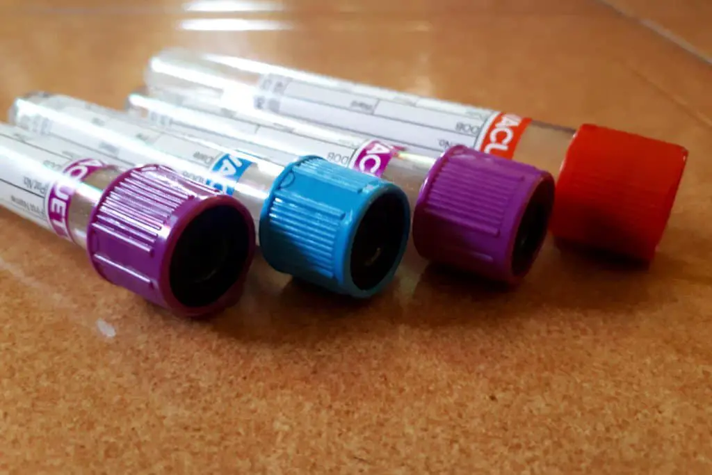 list-of-non-fasting-blood-tests-over-71-phlebotomist-report